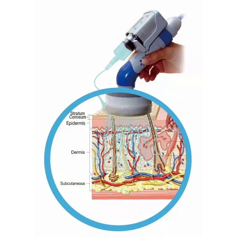 DEP Mesotherapy Water Injection Mesogun Dermoelectroporation