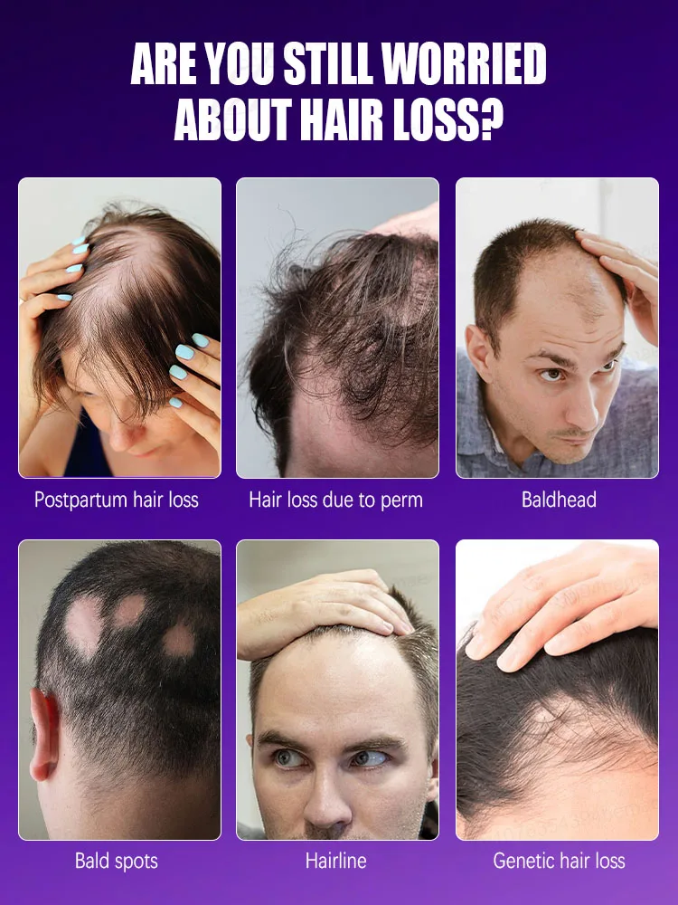 Designed specifically for those suffering from hair loss，No Add chemical stimulation