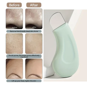 Electric pore vacuum cleaner for blackhead removal with multiple probe heads and USB charging