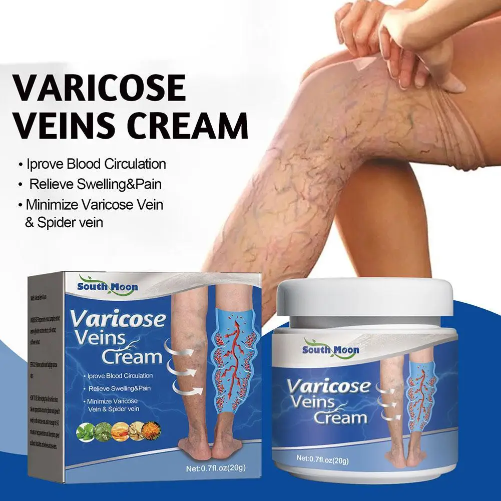 

ointment for varicose veins Effective varicose vein relief cream to relieve Leg vasculitis phlebitis spider pain swelling Care