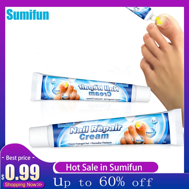 

20G Sumifun Nail Fungus Feet Anti-Infection Onychomycosis Paronychia Treatment Care Against Fungal Antifungal Cuticle Ointment