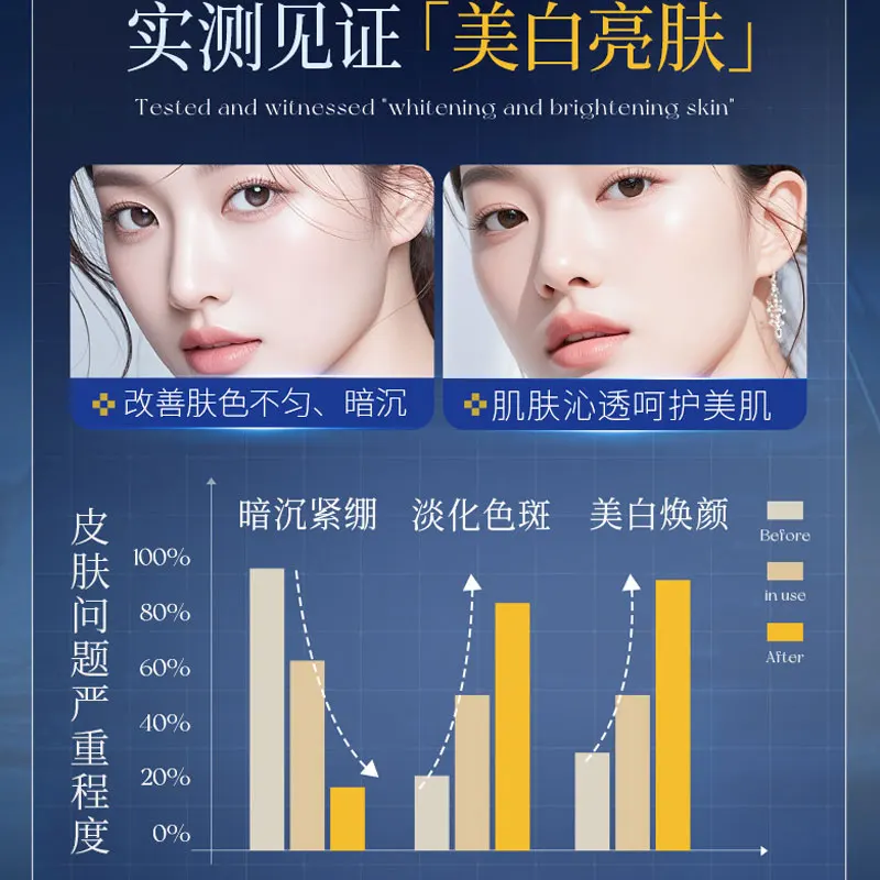 Whitening and Freckle Removal Lotion 100ml Whitening and Freckle Removal Moisturizing Water Emulsion Skin Care Products