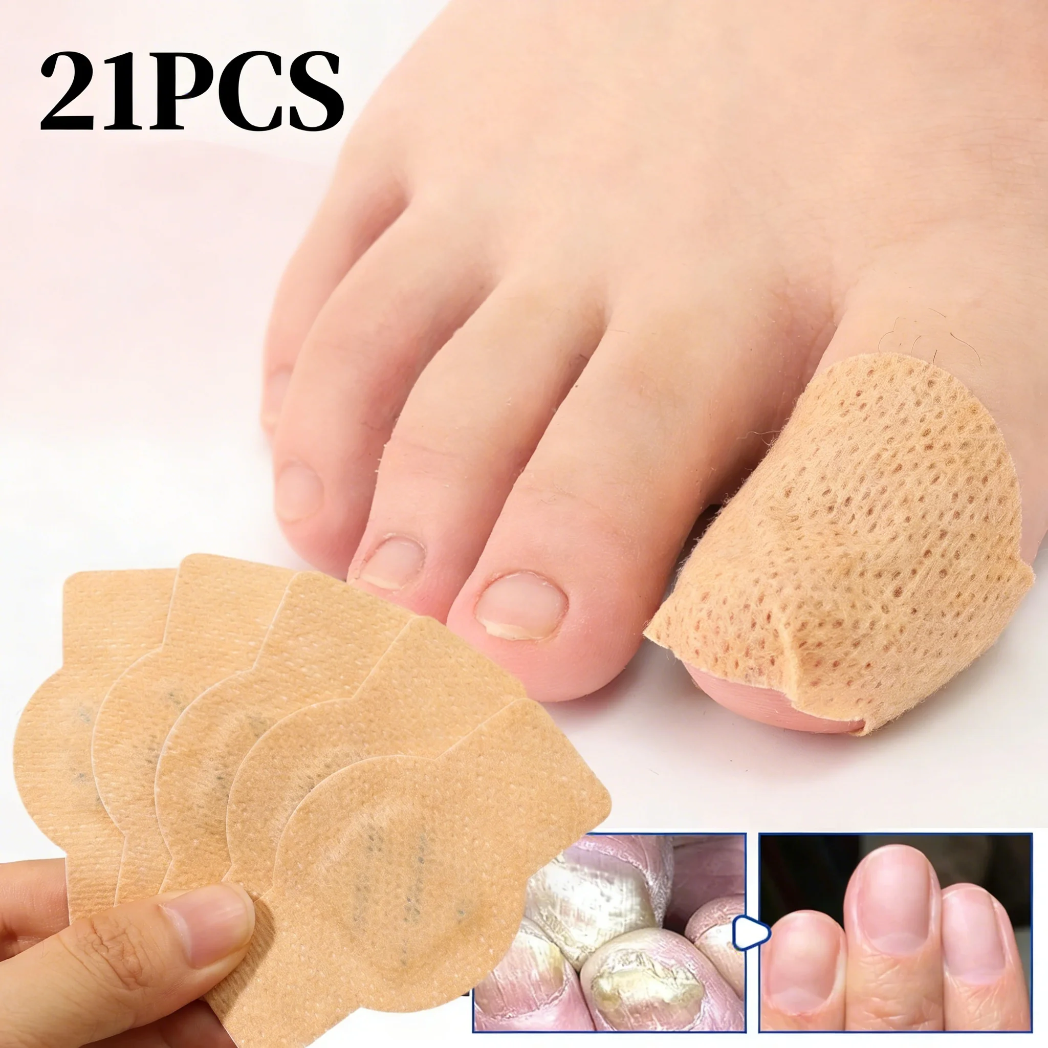 21pcs Waterproof Fungus Patch Ingrown Toenail Correction Sticker Damaged Gray Nail Repair Care Feet Tools_voghion.com