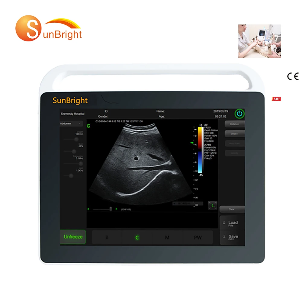 

SUN-800S Diagnostic Ultrasonic System Laptop Digital Ultrasound Scanner Machine For Pet Clinic