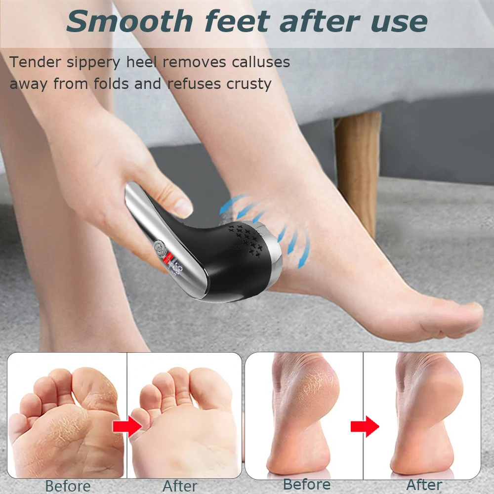Foot Dead Skin Remover Electric Callus Remover Feet Vacuum File