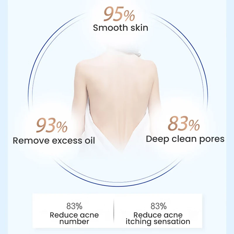 Safeguard Anti-Acne Body Wash Shower Gel Bath Lotion Face Cleanser with Salicylic Acid 360ML/540ml