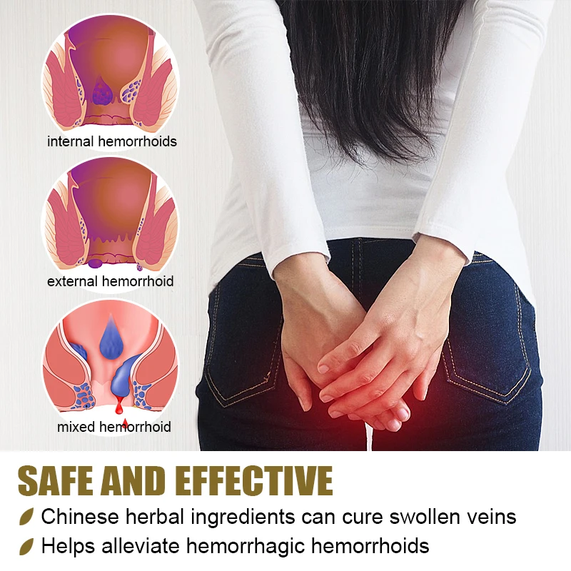 2Pcs Hemorrhoids Ointment Internal Piles External Anal Fissure Cream Relief Anal Pain Swelling Itch Chinese Medicine Cream A1956