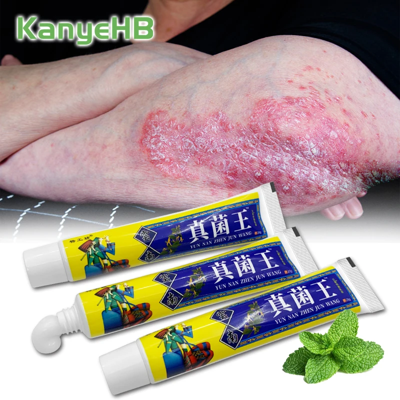 

3pcs Psoriasis Cream Fungal Infection Medical Plaster Relieve Red Swollen Treat Skin Itch Beriberi Ointment Cooling Cream A1544