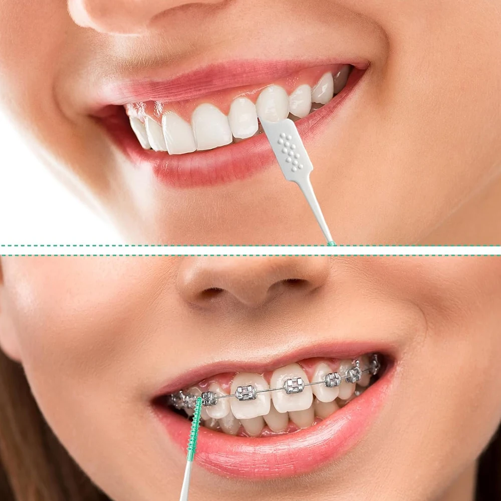 40개/박스 유닛 소프트 글루 치간 칫솔 교정용 특수 틈새 칫솔 일회용 치아 청소용 칫솔