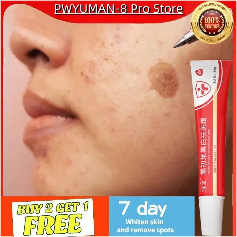 Whitening Freckle Cream 20ml pigmentation remove cream Removal Chloasma Spots remover pigmentation Melanin and Sooth Brightens