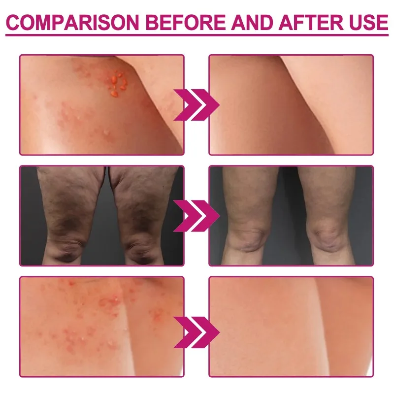 Women Body Lightening Cream Brighten Dull Fade Pimples Moisturize Lotion Butt Inner Thigh Brightening Serum Buttock Smooth Cream whitening body cream whitening cream body lotion brightening cream whitening serum brightening body cream body skin care cream