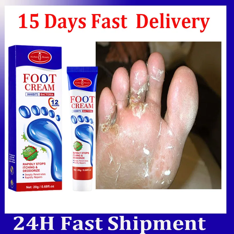 קרם נגד פטריות לרגליים מסיר פטריות מקל על גרד לחות ניקוי עור טיפוח קרם לטיפוח בריברי