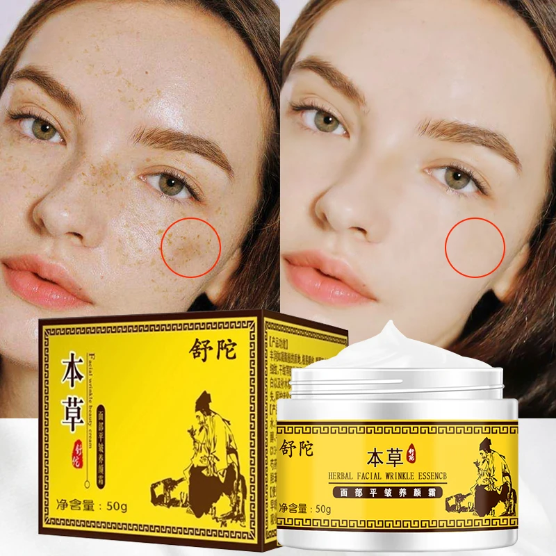 

Whitening And Freckle Removal Of Dark Spots Black Spots Brightening Skin Anti-aging Noodle Noodles Moisturizing Beauty Skin Care
