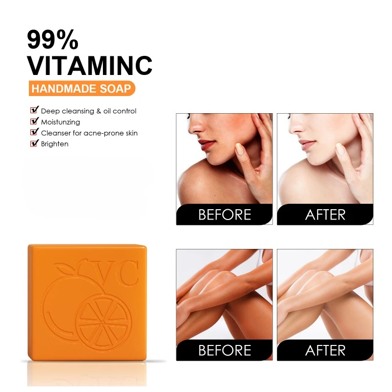 Skin Beauty Bath Soap Body Moisturizing Cleansing Joint Elbow Dark Spot Melanin Acne Reduce Brightening Whitening Body Skin Care