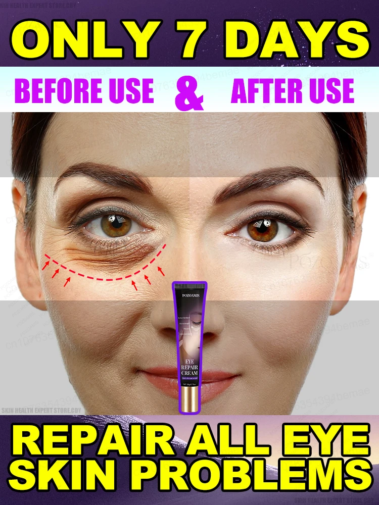 Eye Cream Eliminates Wrinkles Eye Bags Dark Circles Tightens Skin Brightens Skin in 7 Days