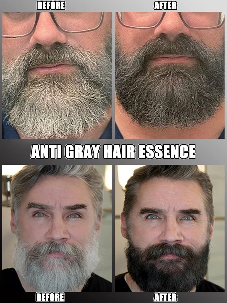 Gray Hair Killer Remove Gray Hair and Restore Original Color in 7 Days! hair color restorer