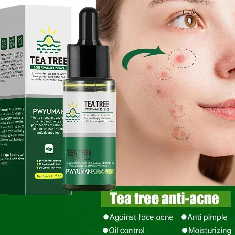 

Tea Tree Acne Removal Serum Acne Treatment Remove Blackheads Pimples Spots Shrink Pore Facial Cleaning Fade Acne Marks Whitening