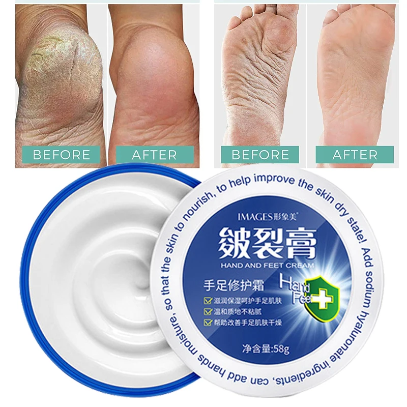 

Hand Foot Repair Cream Anti-Drying Anti-Cracking Moisturizing Whitening Deep Nourishment Remove Dead Skin Hand Feet Care 58g