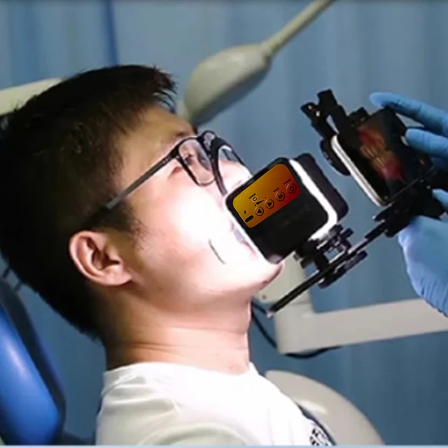 Dental Flash Light Oral Filling Lamp LED Photography Equipment Flashlight for Dentistry