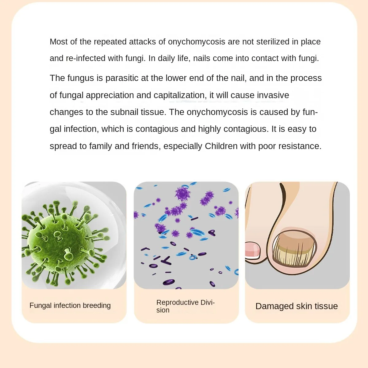 USB rechargeable portable UV remove nail fungus lamp portable auxiliary tool UV Disinfection and killingnail fungus mini lamp