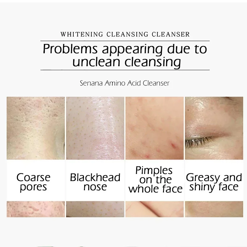 Nicotinamide Amino Acid Face Cleanser Facial Scrub Cleansing Acne Oil Control Blackhead Remover Shrink Pores Skin Care 3