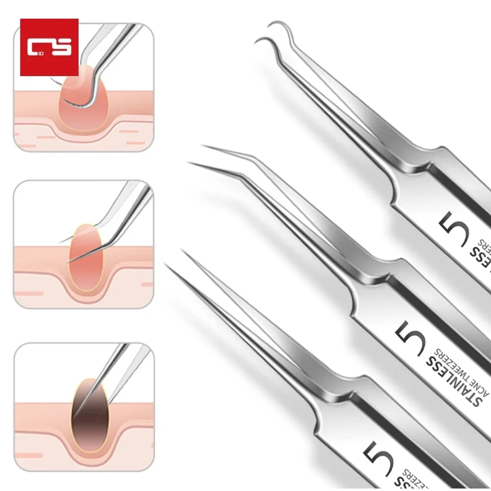 

Ultra-fine No. 5 Cell Pimples Blackhead Clip Tweezers Beauty Salon Special Scraping & Closing Artifact Acne Needle Tool