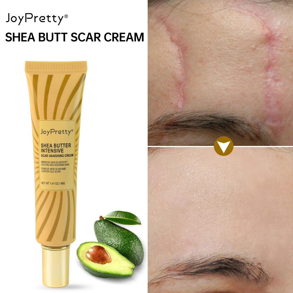 40g Scar Removal Cream Stretch Marks Permanent Skin Care Shea Butter