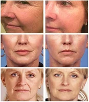 Collagen facial essence whitening moisturizing brightening Korean cosmetics 2