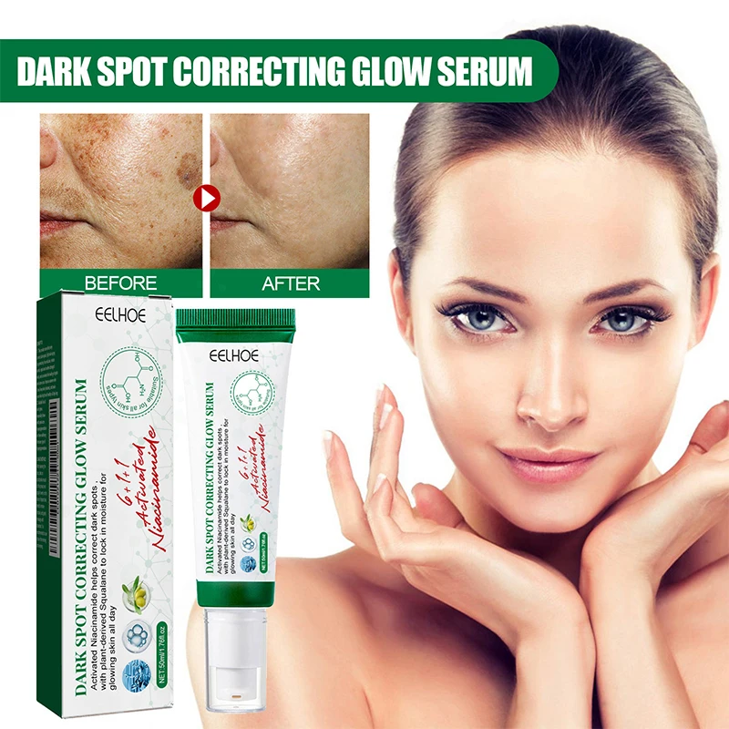 Facial Serum Dark Spot Correcting Glow Moisturizing Brightening Whitening Cream Reduce Freckles Dullness Acne And Melanin