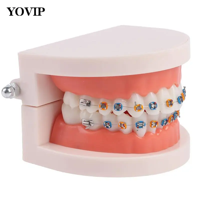 

1Pc School Teaching Equipment home furnishings Dental Orthodontic Teeth Model Dental Orthodontic Teeth Model With Metal Braces