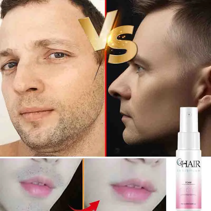Hair Growth Inhibitor Spray 2