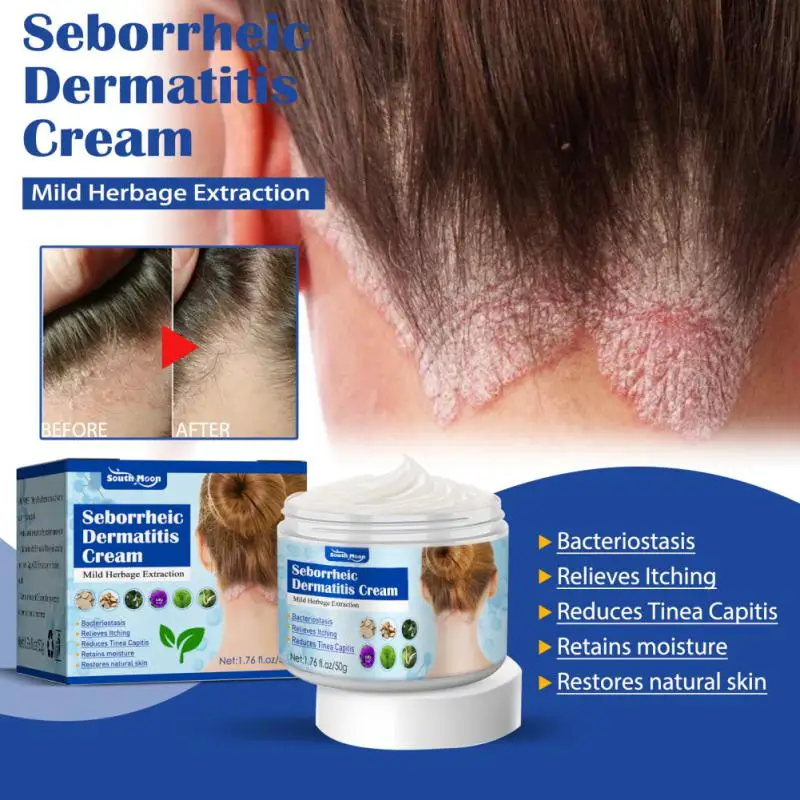 50g Seborrheic Skin Cream Head Acne Pruritus Scalp Ringworm Skin Problem Repair Cream Cleansing Hair Scalp Care hair care products