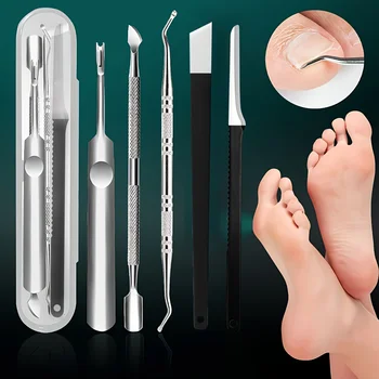 Kit pedicure per la cura dei piedi - Lime multifunzionali per piedi, raspa, esfoliante per una pelle liscia - Regalo per la festa della mamma per donne e mogli 1