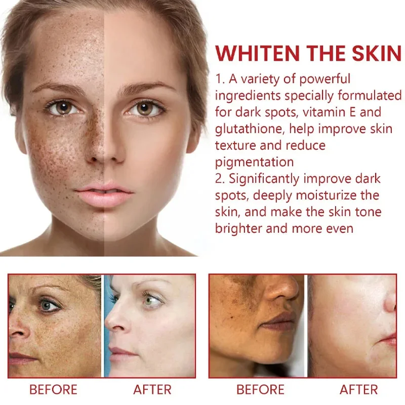 Whitening Body Cream Effective Whitening Freckle Cream Remove Dark Spot Lotion Removal Melanin Melasma Lighten Brighten Anti-Aging Skin Care Products,facial cream