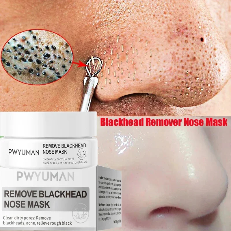 

White Blackhead Remover Nose Mask Pore Shrinkage Treat Pimple Deep Cleansing Repair Products Oil Control Korean Skin Care