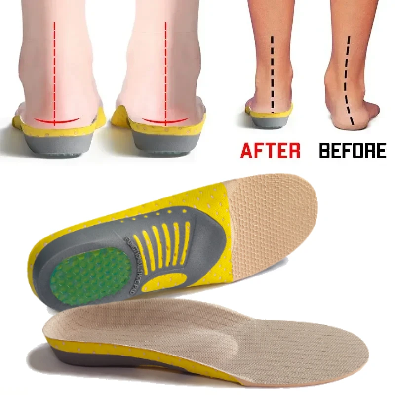 Upgrade Orthotic Gel Insoles Orthopedic Flat Foot Health Sole Pad