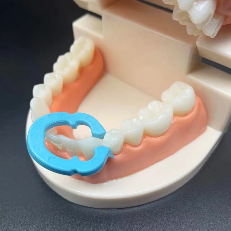 Рисунок 4 - зажимное кольцо из стоматологической смолы