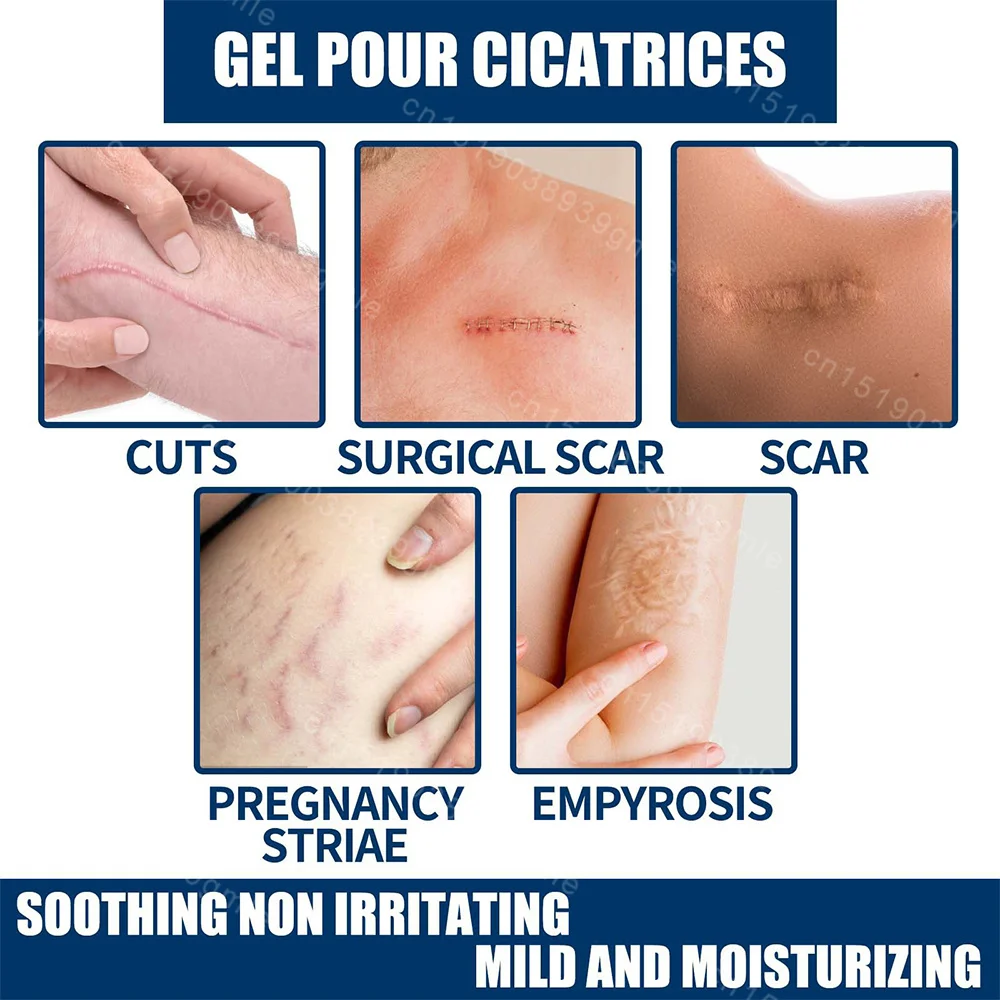 Recovery Scar Cream Fast Removal Skin Scars Treat Surgery Scars Stretch Marks Acne Pox Prints Burn Repair Facial Care Gel pain analgesic cream