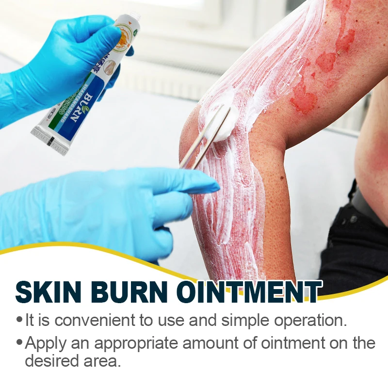 20g Burns Scald Cream Fungal Inhibition Wound Skin Repair Ointment Herbal Extract Anti-infection Pain Relief Medical Cream