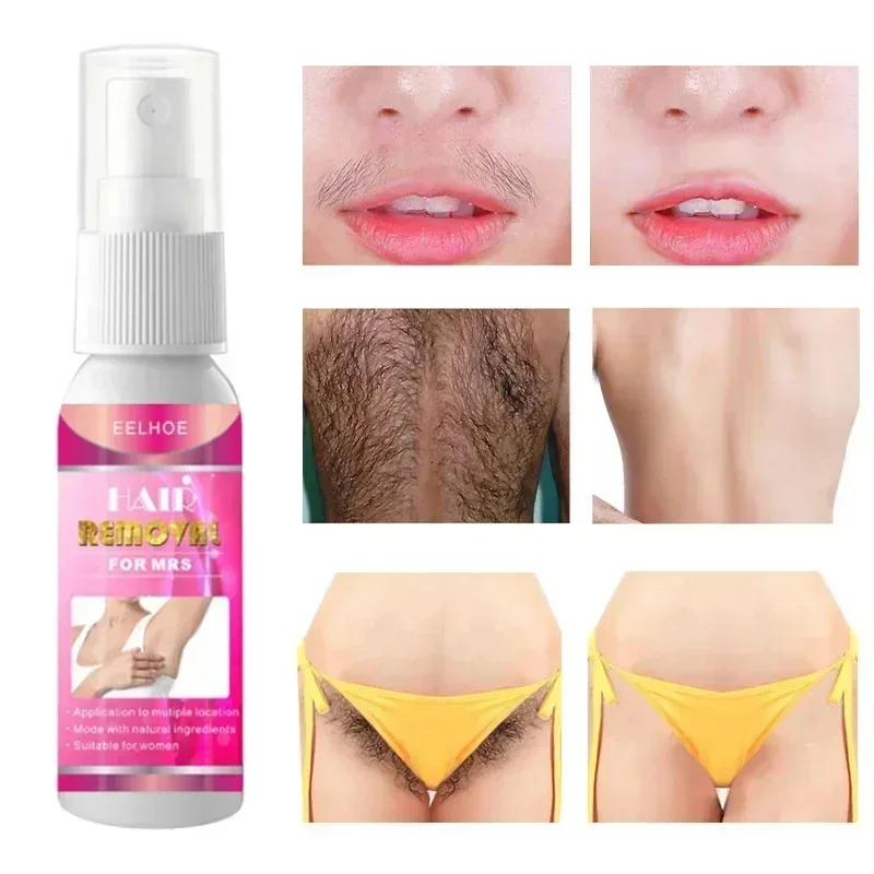 Fast Painless Hair Removal Spray Body Chest Hair Armpit Legs Arm Private Parts Skin Care Beard Remover Painless Depilation Cream 4