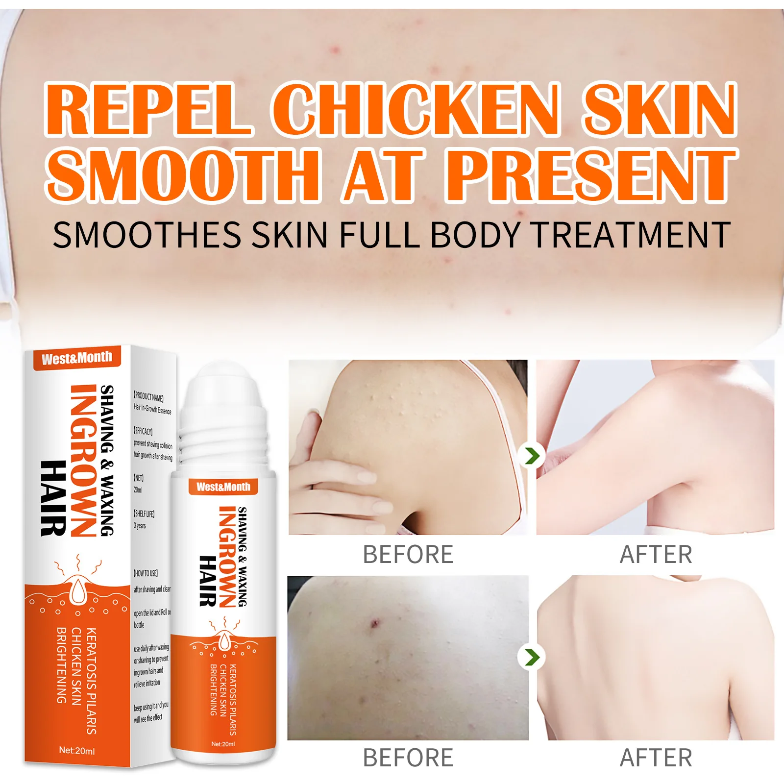Ingrown Hairs Treatment After Shave Repair Serum Solution Dark Spot Reduce Redness for Vanish Pfb Skin Care Prevent Razor Bumps hair removal skin care