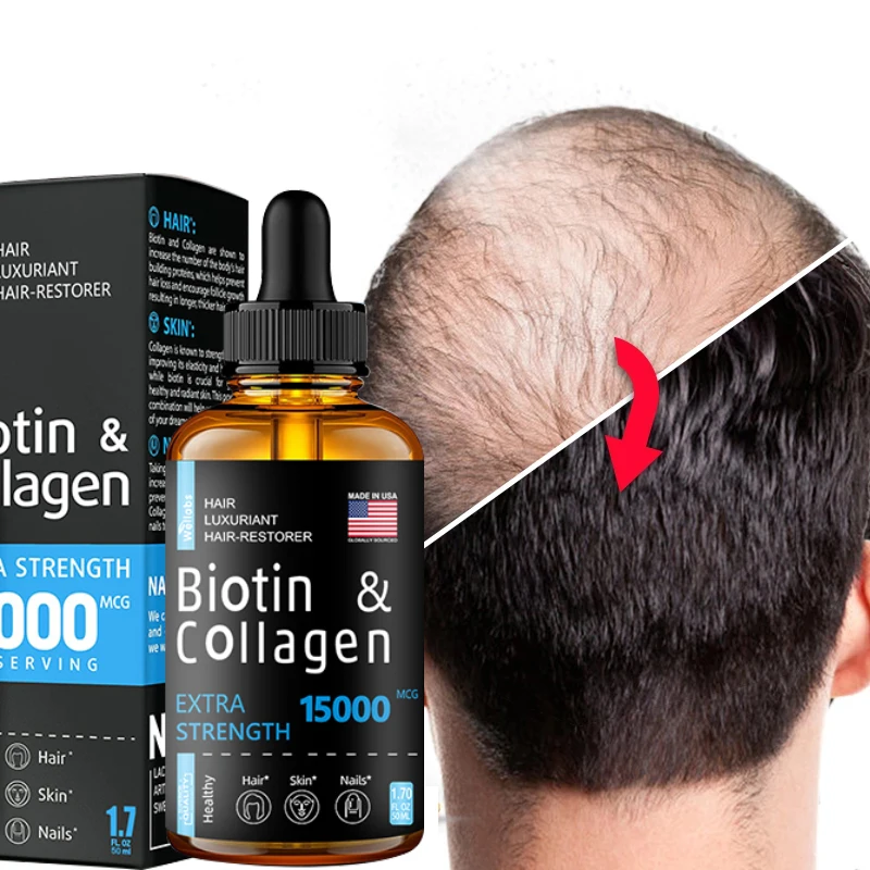 Hair Growth Products Ginger Essence Fast Regrowth Serum Beard Growth