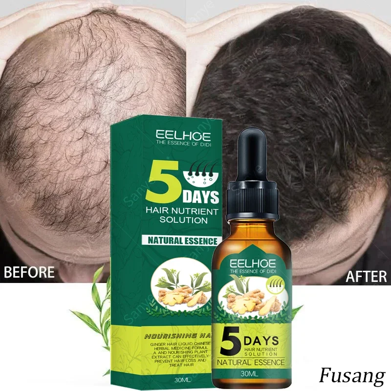 

Women Ginger Fast Hair Growth Serum High Hairline Anti Alopecia Essence Bald Head Men Quickly Increase Head Hair Essential Oil