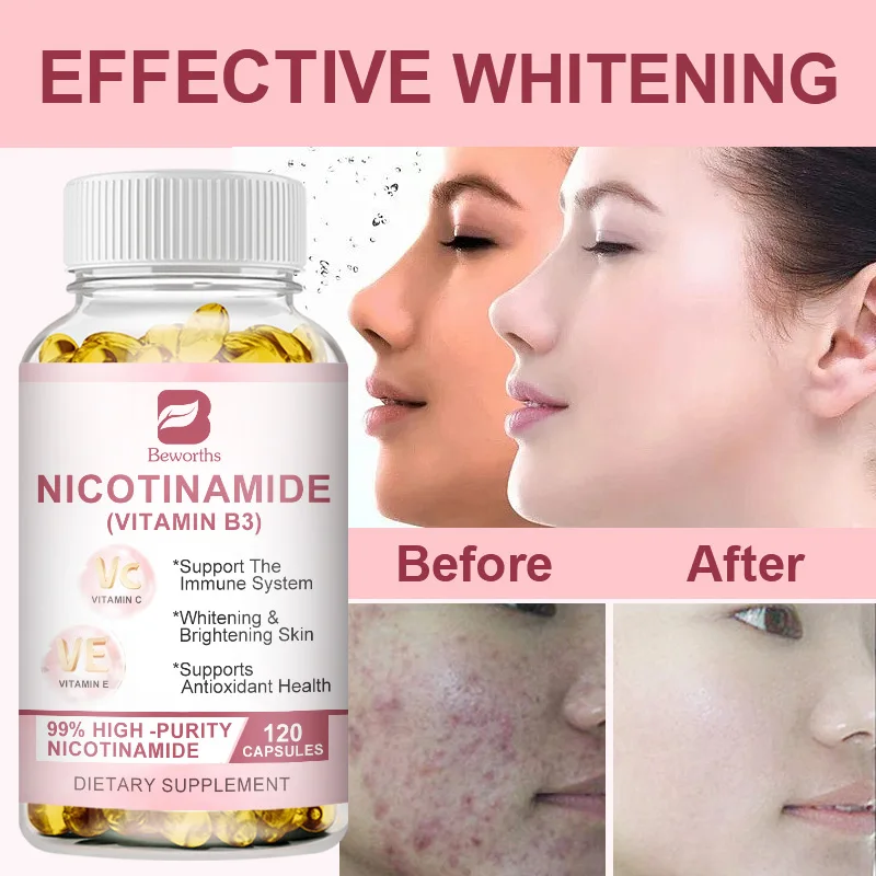 

BEWORTHS Nicotinamide Whitening Capsule With Vitamin B3 Antioxidant Brightens Skin Tone Repairs Skin Baby Muscle Freckle Removal
