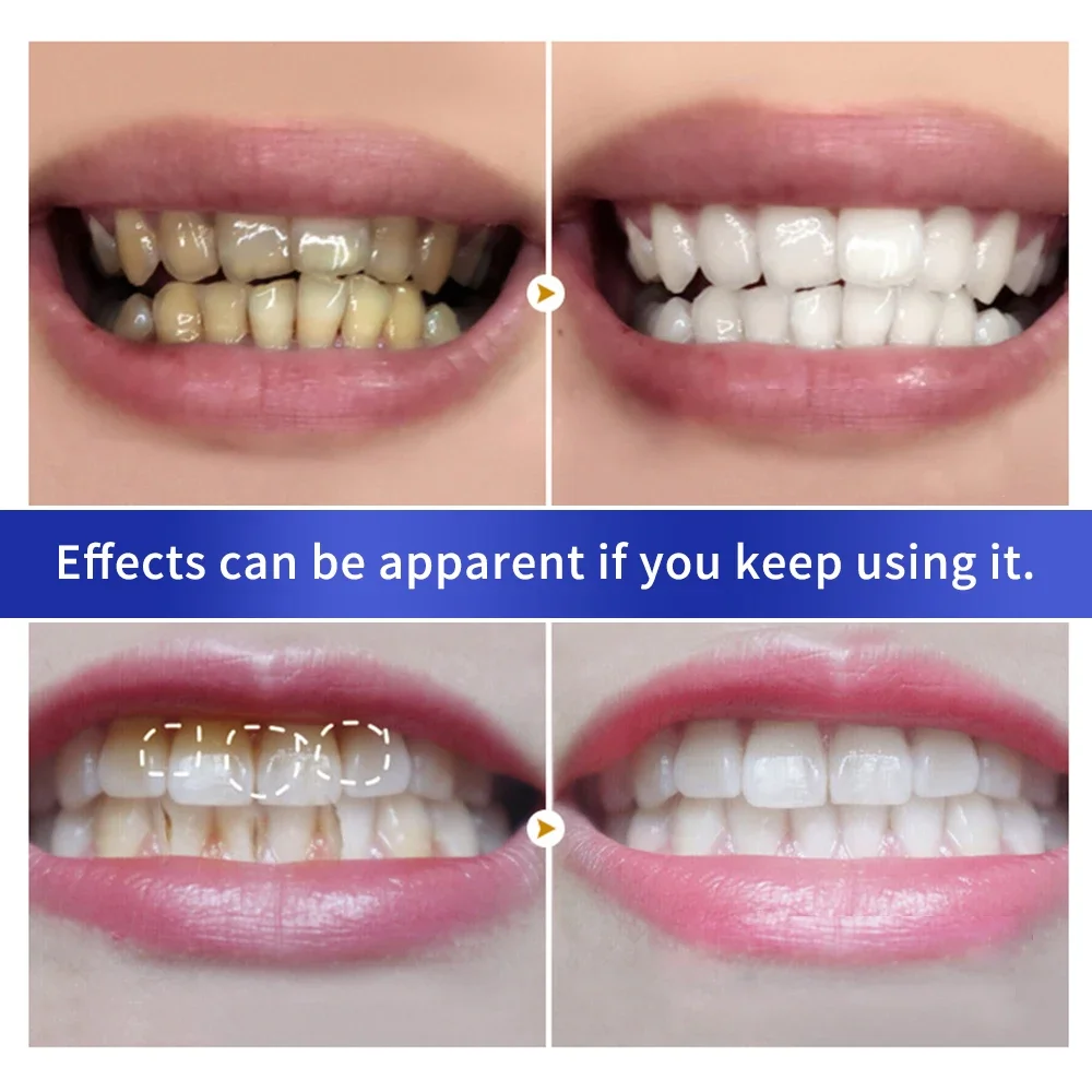 Teeth Whitening Powder Teeth Whitening Toothpaste Teeth Whitening Gel Teeth Cleaner Teeth Whitening Powder Remove Plaque Stains Toothpaste Dental Tools White Teeth Cleaning Oral Hygiene Toothbrush Gel