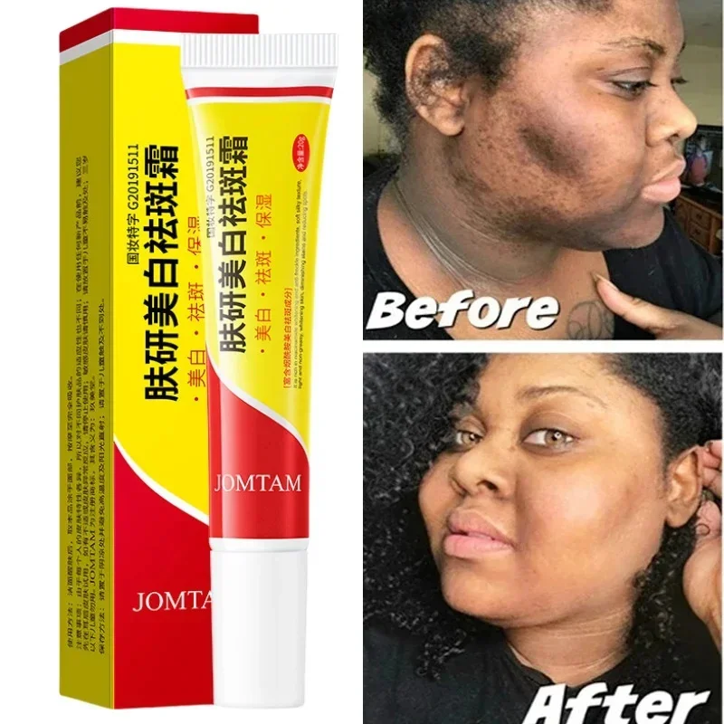 

Face Brightening Cream Niacinamide Reduce Melasma Melanin Brighten Cream Lighten Dark Skin Chloasma Serum Weaken Fine Lines Care