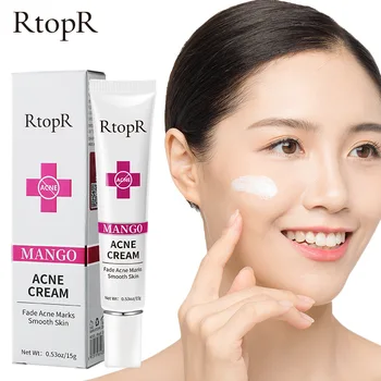 RtopR Mango Anti-acne Facial Cream Gel Pimple Remover Remedy Shrinks Pores Ointment Nourishing Acne Treatment Face Care