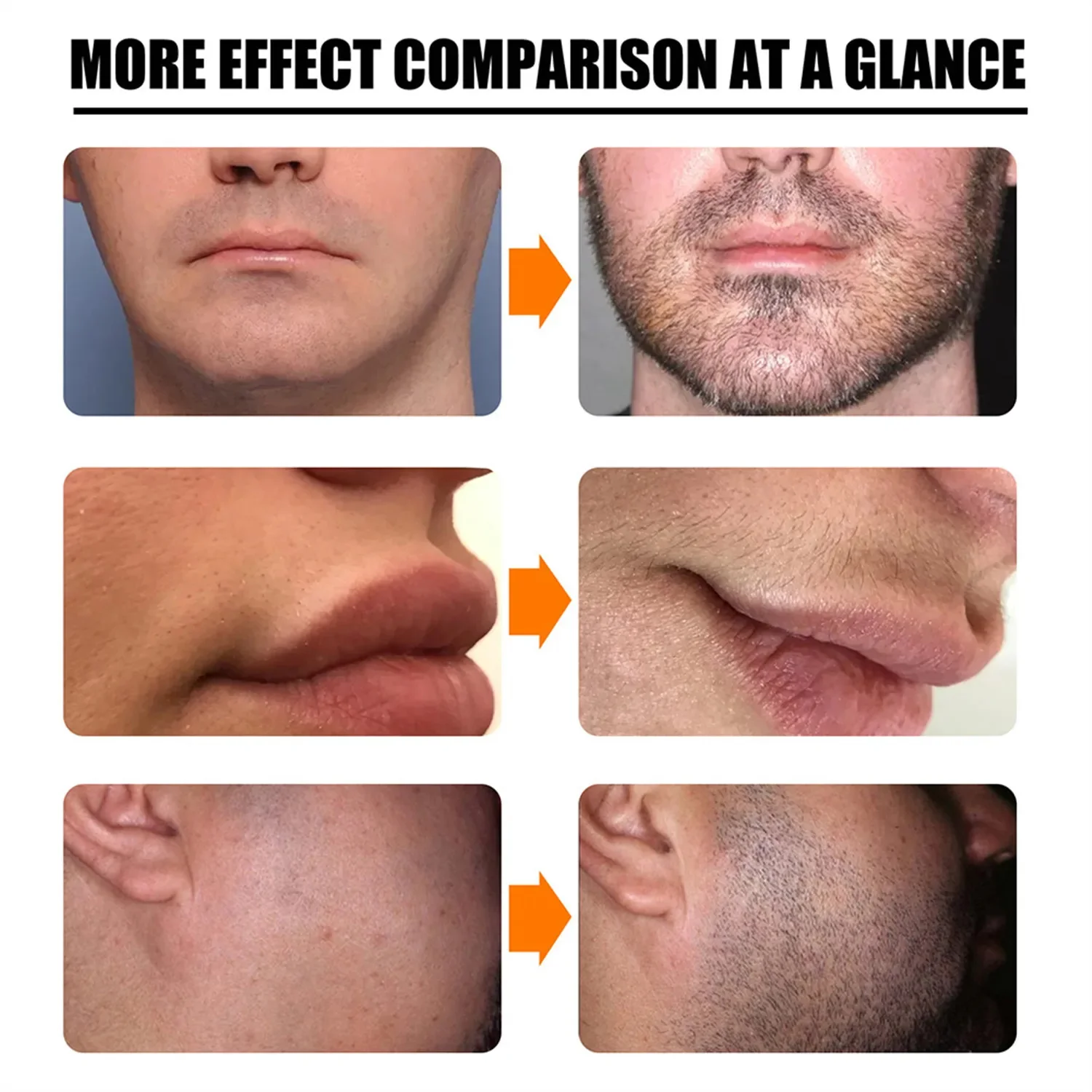 Beard Growth Oil Beard Wax Balm Hair Loss Products Leave-In Conditioner for Groomed Chest Hair Moustache Oil Beard Care 30ml - Image 2