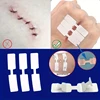 5Pcs Outdoor Wound Adhesive Tape Disposable First Aid Wound Suture Patch Wound Band Aid 1