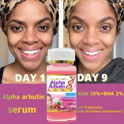 Alpha Arbutin Serum Remove Spots Keeps Smooth Soft Hydrating Even Face Whitening Cream for Dark Skin Care Facial Beauty Women